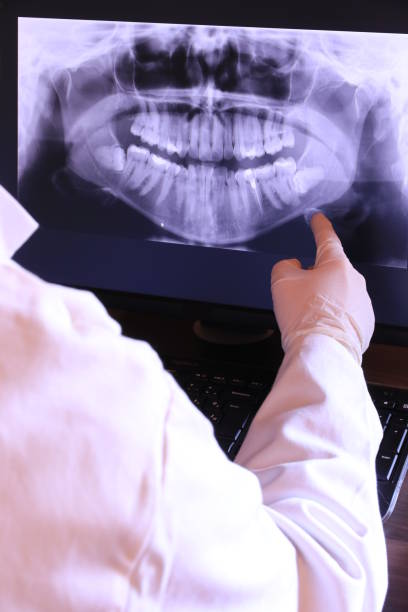 Best Emergency Wisdom Tooth Extraction in Lakeland North, WA
