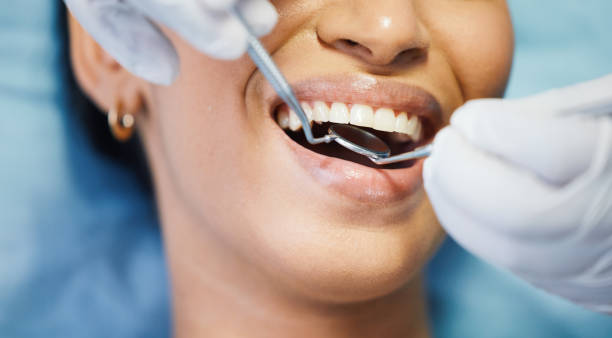 Best Emergency Cosmetic Dentistry (e.g., broken veneers) in Lakeland North, WA
